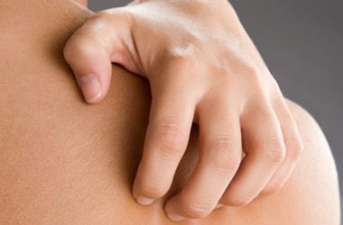 Elderly Skin Condition