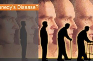 What is Kennedy’s Disease?